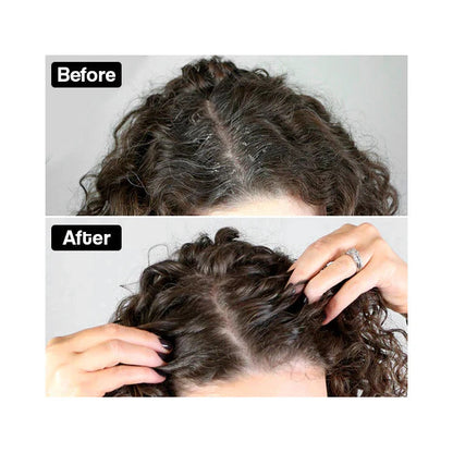 Tiefenreinigender Kopfhaut-Kamm